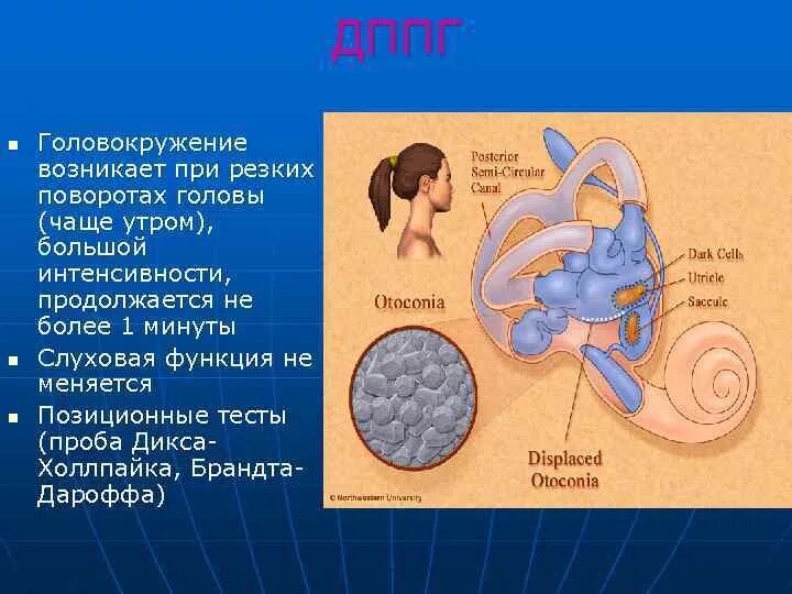 Головокружение в лежачем положении. Головокружение при повороте головы. головокружение из за внутреннего уха. при повороте головы на право кружится голова. кружиться голова при вращении.
