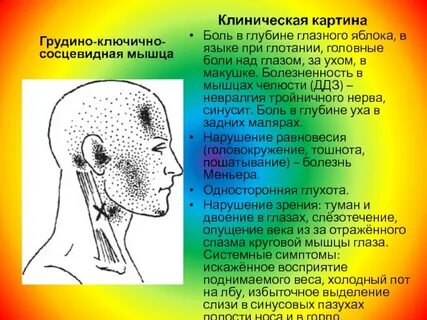 Симптом грудино ключично сосцевидная