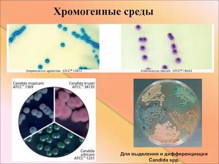 Селективно диагностические среды
