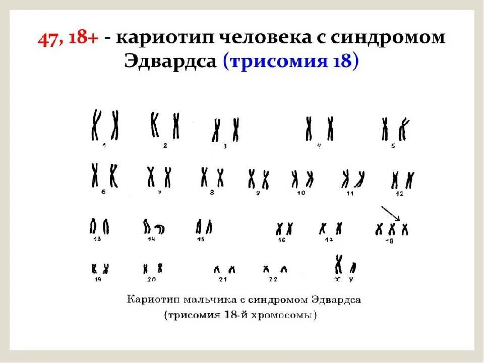 Сколько хромосом у кошки. Набор хромосом кошки. Сколько пар хромосом у кошек. Хромосомы кошек и котов. Форма хромосом у кошки.