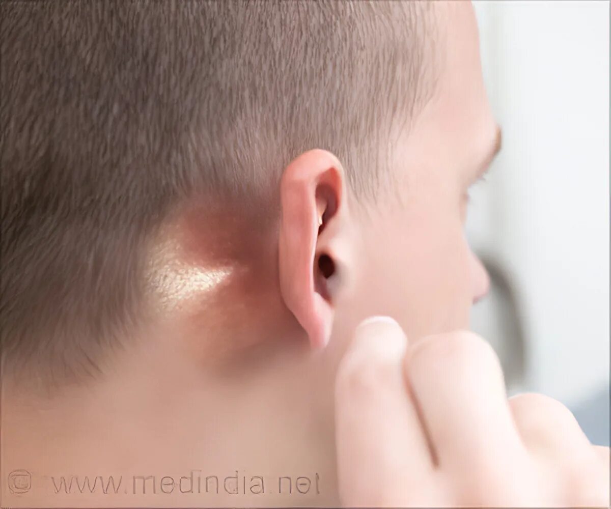 Слуховой аппарат AcoSound L8 IF Digital CIC невидимые слуховые усилители програм