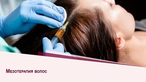 Фракционная мезотерапия головы