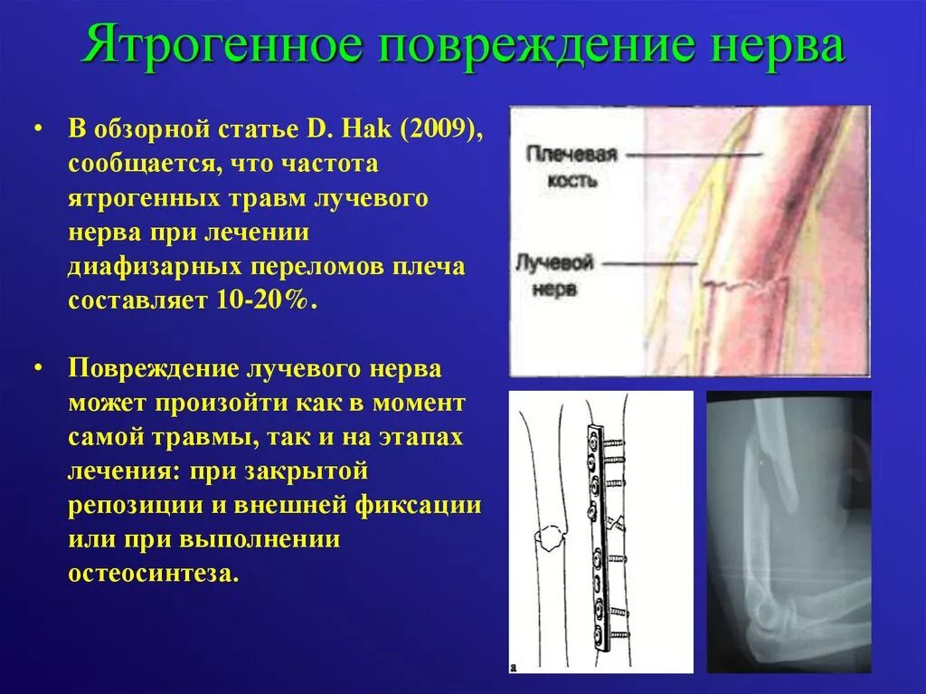 Повреждение периферических нервов. Травмы периферических нервов. Ушиб периферического нерва.