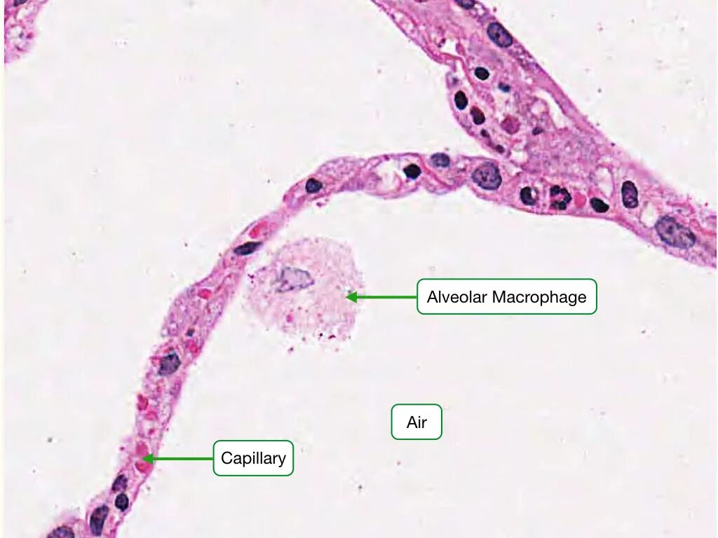 Легочные макрофаги гистология. Альвеолярные макрофаги гистология. Макрофаг гистология препарат. Макрофаг на гистологическом препарате.