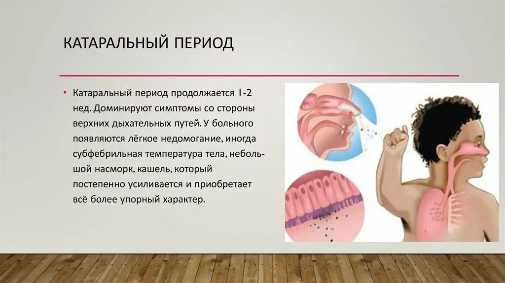 Катаральный грипп. Катаральный период кори. Катаральные явления со стороны верхних дыхательных путей.