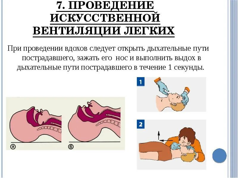 Открытие дыхательных путей пострадавшего без сознания. Попадание еды в дыхательные пути. Кусок еды попал в дыхательные пути. Метод открытия дыхательных путей пострадавшему.