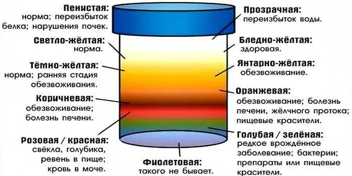 Может ли моча менять. Цветность мочи норма. изменение цвета мочи при патологии. темная моча при панкреатите. цвет мочи обезвоживание.