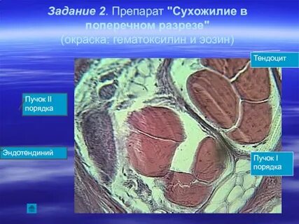 Перитеноний