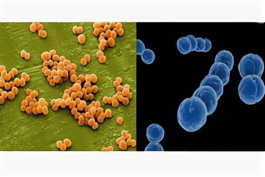 Staphylococcus viridans