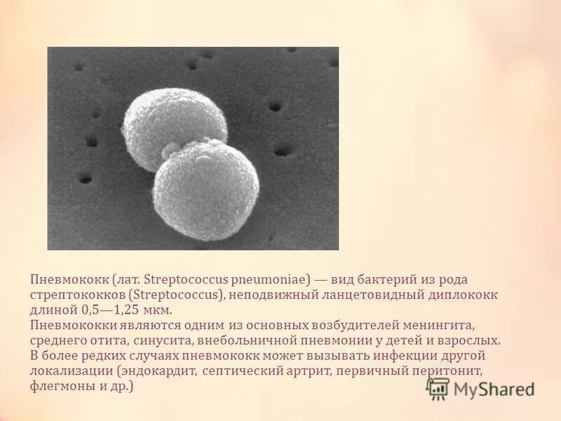 пневмококк осложнения. пневмококковая инфекция возбудитель. пневмококк (диплококк). пневмококки микробиология морфология. возбудитель внебольничной пневмонии пневмококк.