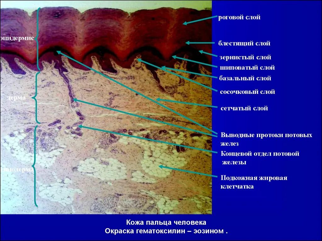 Сосочковый и сетчатый слой. Кожа пальца человека гистология препарат. Препарат кожа пальца человека окраска гематоксилин эозин. Кожа пальца человека окраска гематоксилином и эозином. Строение кожи пальца гистология.
