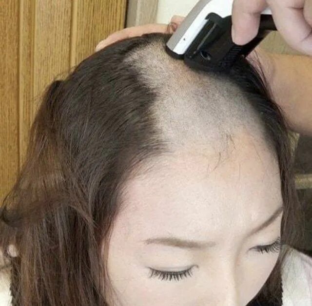 Forced head. Китайская прическа с выбритым лбом. азиатка с бритой головой. девушка headshave. электробритва для бритья головы.