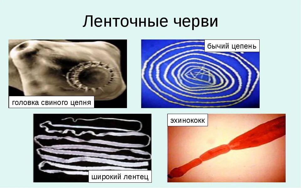 Бычий цепень замкнутая кровеносная система. Ленточные черви свиной бычий цепни. Плоские черви ленточные черви представители. Ленточные черви бычий цепень. Представители плоских червей ленточные черви.