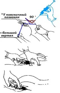 Как сделать укол кошке в бедро