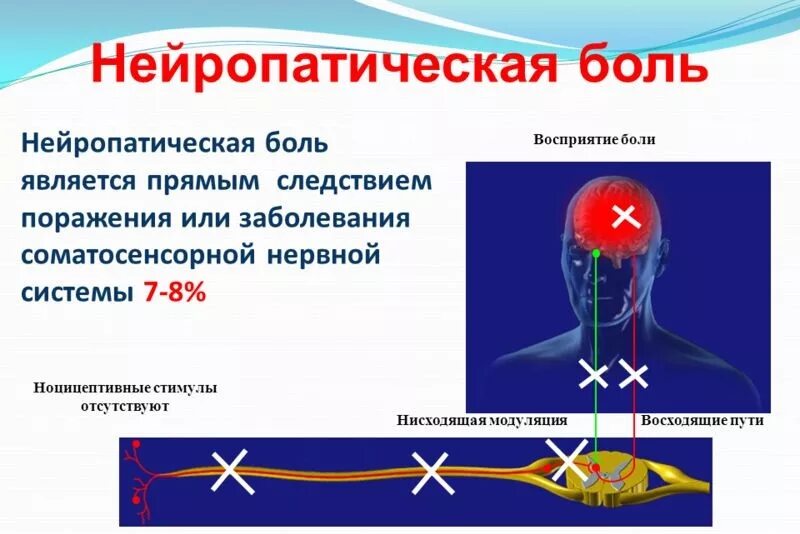 Нейропатическая боль в спине. Нейропатические боли. Невропатическая и нейропатическая боль. Хроническая нейропатическая боль. Симптомы нейропатической боли.