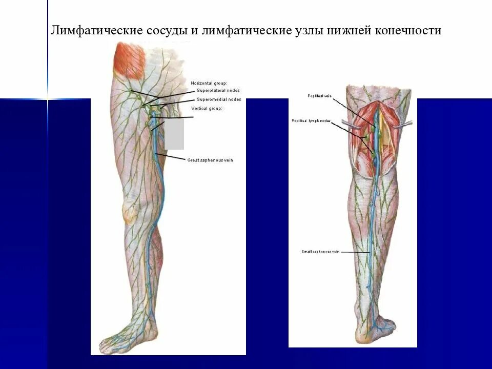 Глубокий лимфатический сосуд. Поверхностные лимфатические узлы бедра. Лимфатическая система нижних конечностей схема. Регионарные лимфоузлы нижней конечности. Лимфатическая система нижней конечности анатомия.