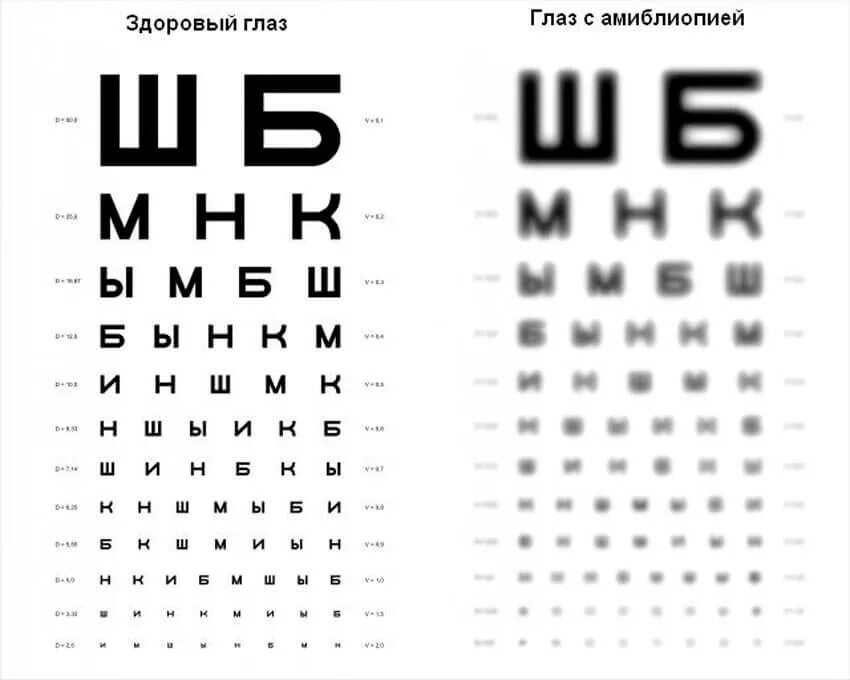 В даль не вижу какое зрение. В даль не вижу какое зрение