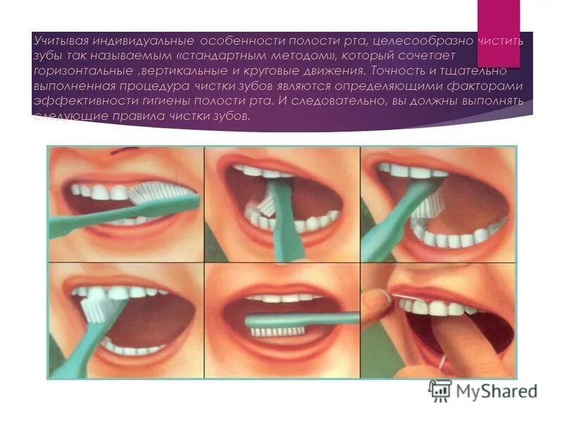 Как чистить зубы после удаления зуба