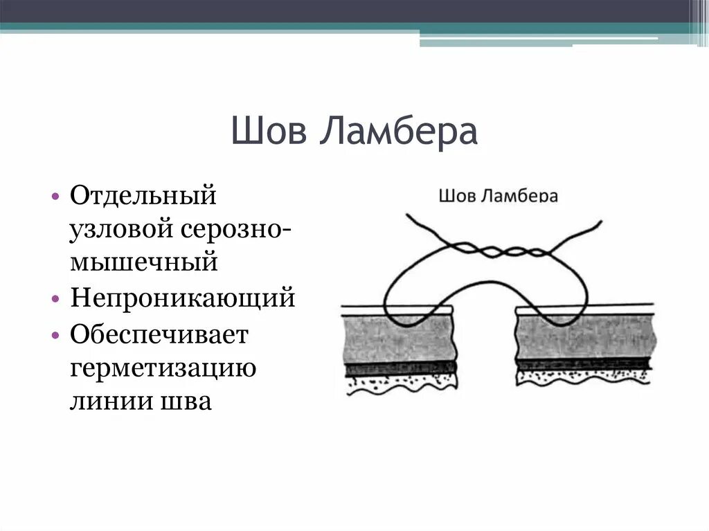 Стерильный шов. Шов Шмидена Ламбера схема. Серозно мышечный шов Ламбера. Серо серозный шов Ламбера. Серозно серозный шов Ламбера.