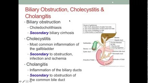 Cholelithiasis латынь