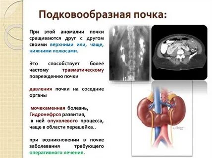 Почечный что это значит