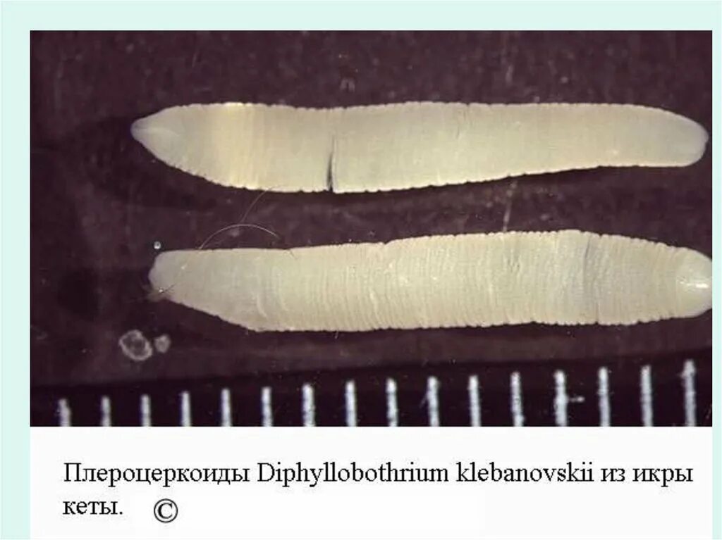 Diphyllobothrium latum плероцеркоид. Широкий лентец (Diphyllobothrium latum). Широкий лентец плероцеркоид. Широкий лентец процерклид.