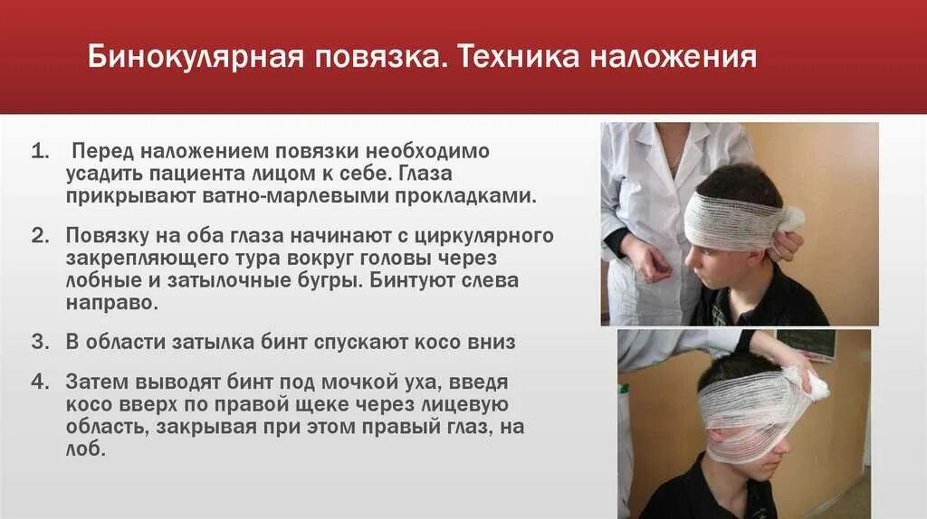Наложение асептической повязки алгоритм. Наложение бинокулярной повязки на оба глаза. десмургия бинокулярная повязка. бинокулярная повязка на оба глаза. повязка на оба глаза десмургия.