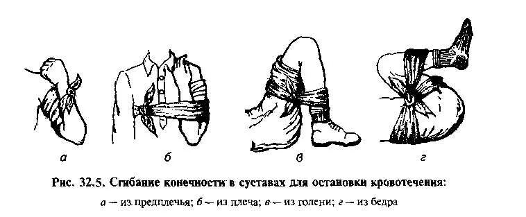 Остановка кровотечения из голени. Сгибание конечности в суставе. Остановка кровотечения сгибанием конечности в суставах. Остановка кровотечения из предплечья.