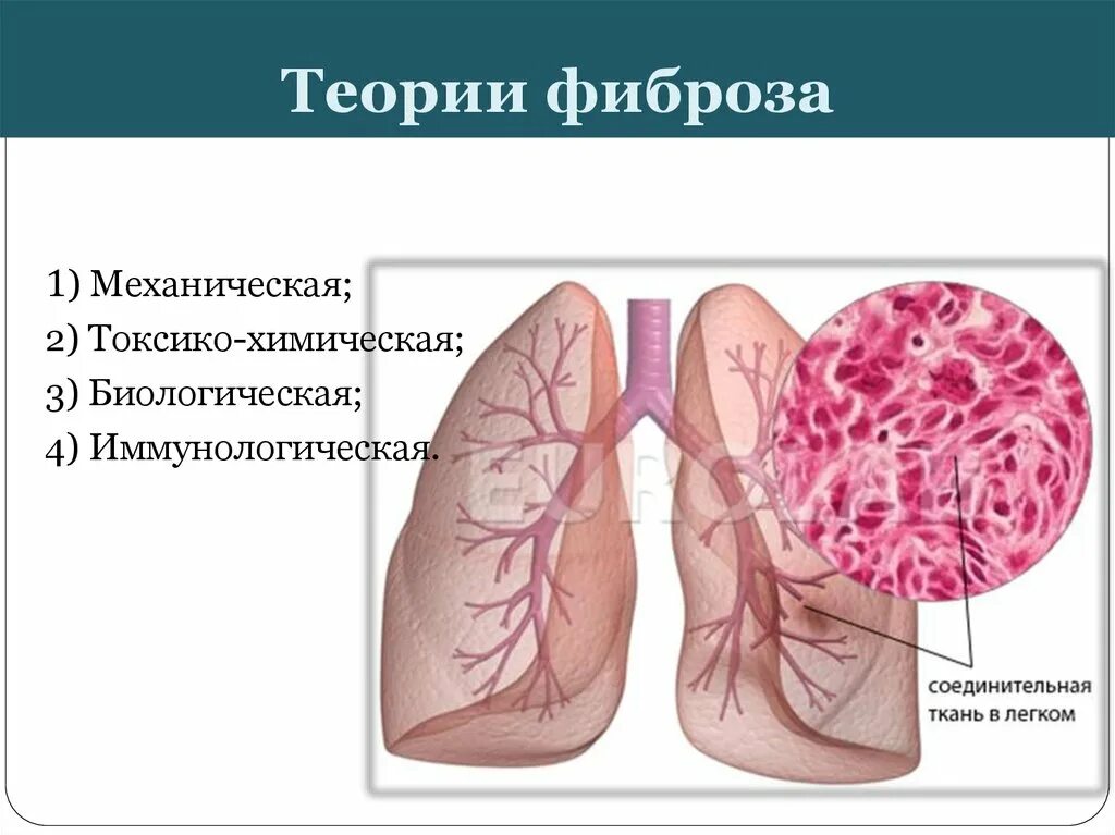 Умеренные фиброзные изменения