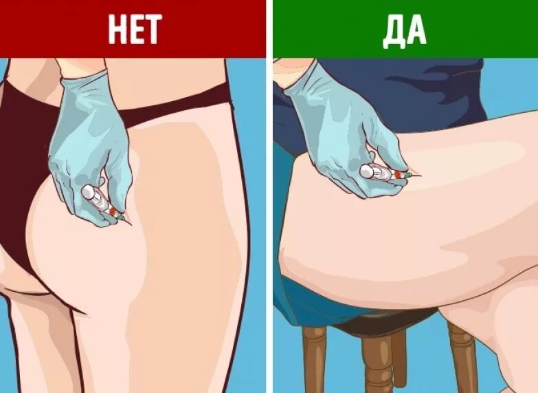 Как самой себе сделать укол внутримышечно в бедро. Укол в бедро внутримышечно самому. Внутримышечное введение. Как правильно сделать укол внутримышечно. Как ставить внутримышечный укол.