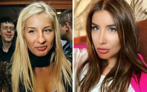 Кэти топурия до пластики
