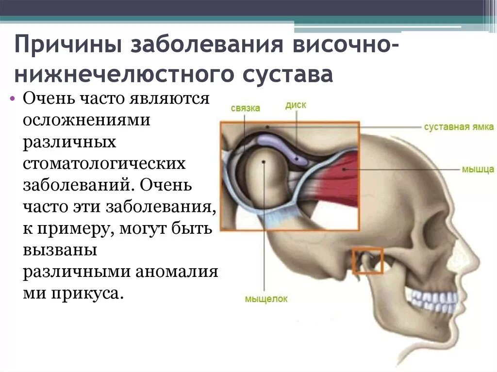 Лицевой артрит. Патология височно-нижнечелюстного сустава. Блоковидный сустав ВНЧС. Суставные симптомы при заболеваниях ВНЧС.