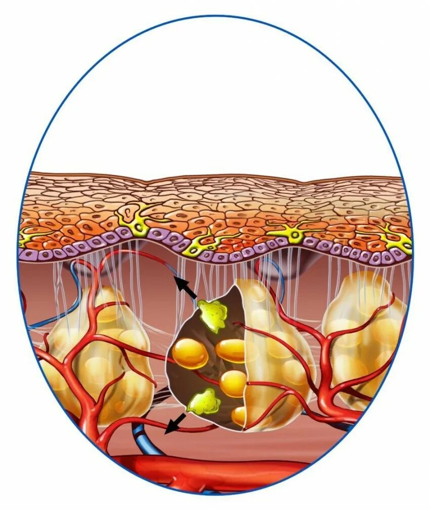 Капсула жировика. Подкожно-жировая клетчатка липома. Липома жировой клетчатки.