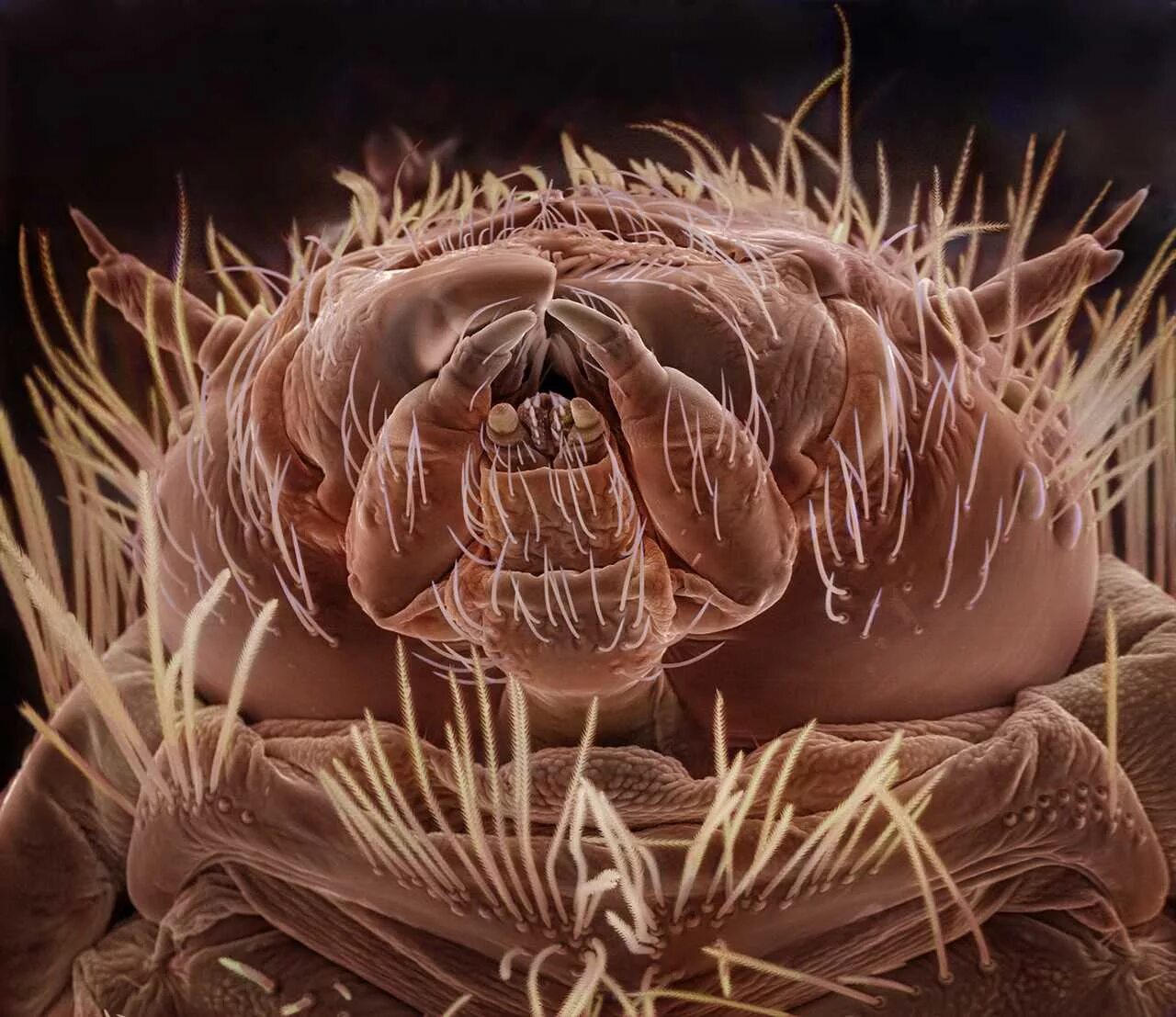 Насекомое живет в теле. Насикомыепод микроскопом. Насекомые под микроскопом. Страшные микробы под микроскопом.