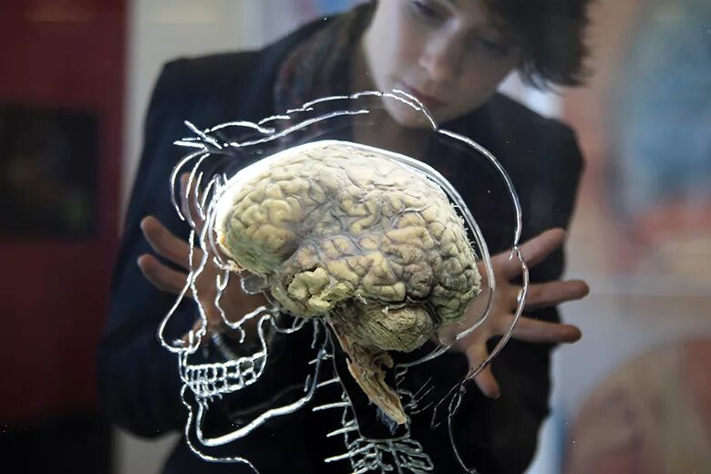 A blow to the head 'increases the risk of dementia by nearly two-thirds' The Sun