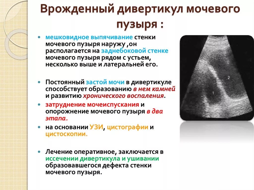 Диффузное изменение мочевого пузыря. Диффузное изменение мочевого пузыря
