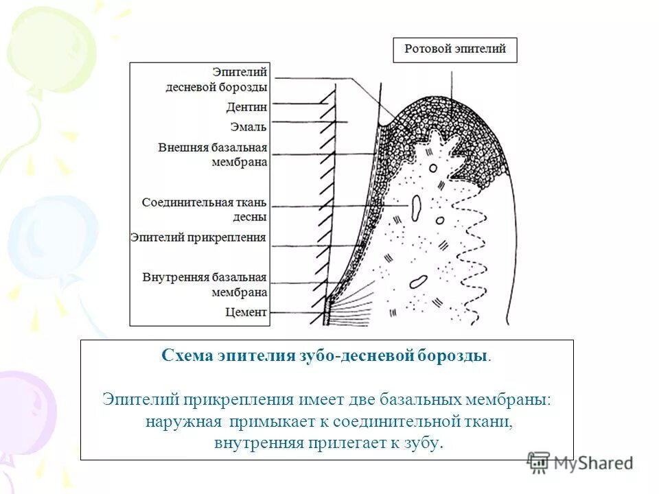 Эпителий зубодесневой борозды. Схема десневой борозды. Десневая борозда гистологическое строение. Эпителиальное прикрепление зуба.