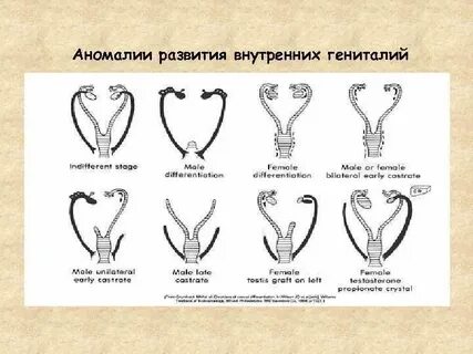 Аномалий развития женских
