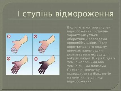 Ступінь