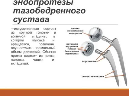 Тазобедренный сустав операция какой наркоз