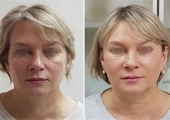 рустем каримов пластический хирург