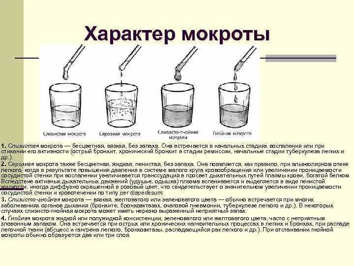 Мокрота определение. Схема вид мокроты. Цвета мокроты при различных заболеваниях. Характер мокроты при бронхите. Цвет мокроты при остром бронхите.