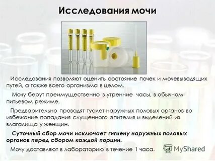 За сколько выходит моча из организма