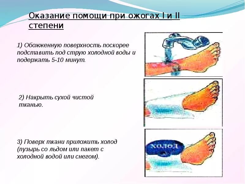 Ожоги обж 8 класс. Термический ожог у детей таблица. Схема при термических ожогах.