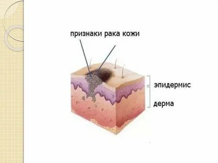 Изменение участка кожи