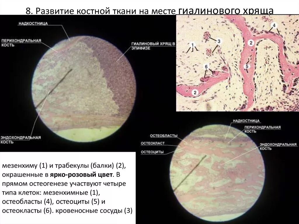 Пограничная гистология. Развитие кости на месте хряща гистология препарат. развитие кости на месте хряща непрямой остеогенез. развитие кости на месте хряща трубчатая кость. непрямой остеогенез препарат.