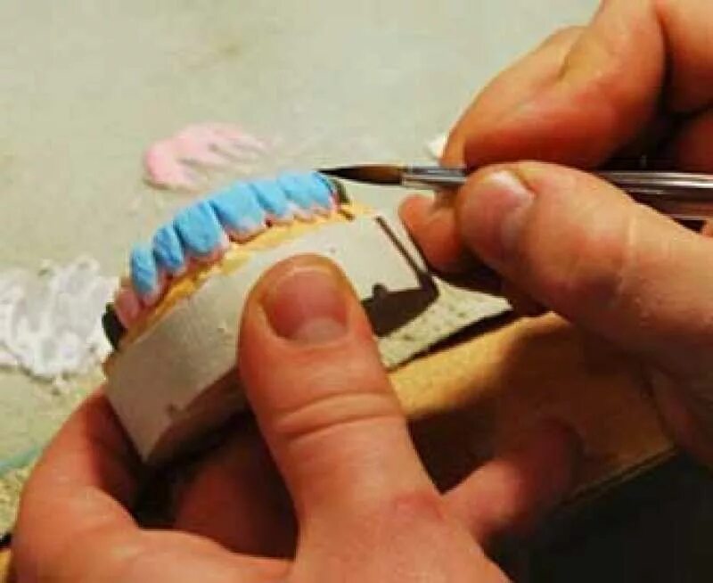 бразильский зубной техник бюгелист. зуботезническая лаборатория. зубные техники. зубной техник без опыта. зубной техник без опыта.