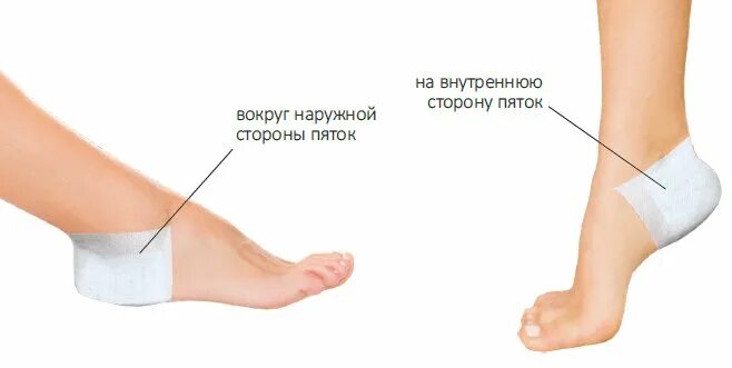 Под какую пятку кладут 5. Перцовый пластырь на пятку. пяточная шпора пластырь. перцовый пластырь на пятки.
