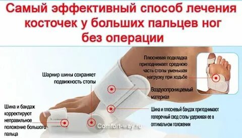 Почему растут косточки на пальцах
