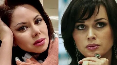 Заворотнюк до и после пластики